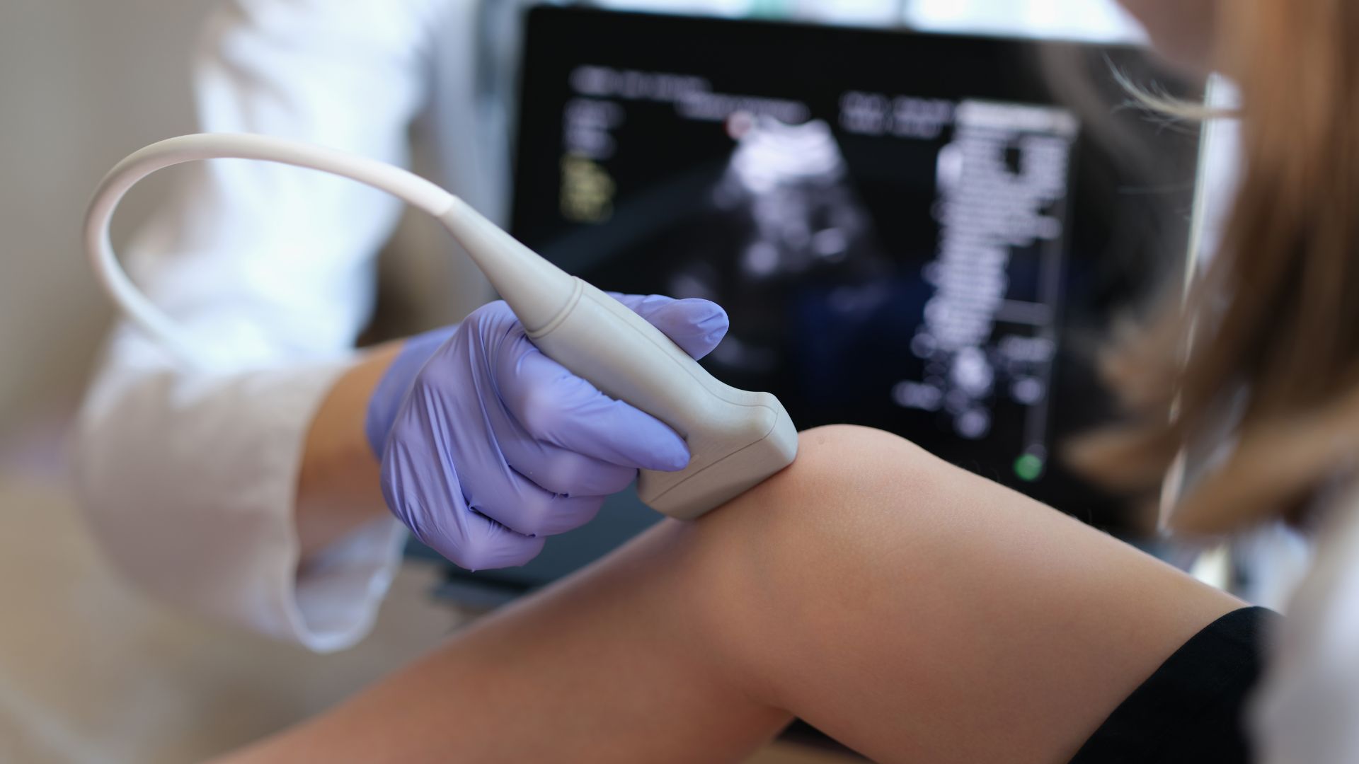 Realize o exame de ultrassom articulações em Santa Luzia com Dr Mauro de Almeida. Diagnóstico preciso e atendimento humanizado.